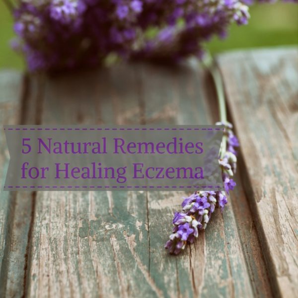 eczema remedies